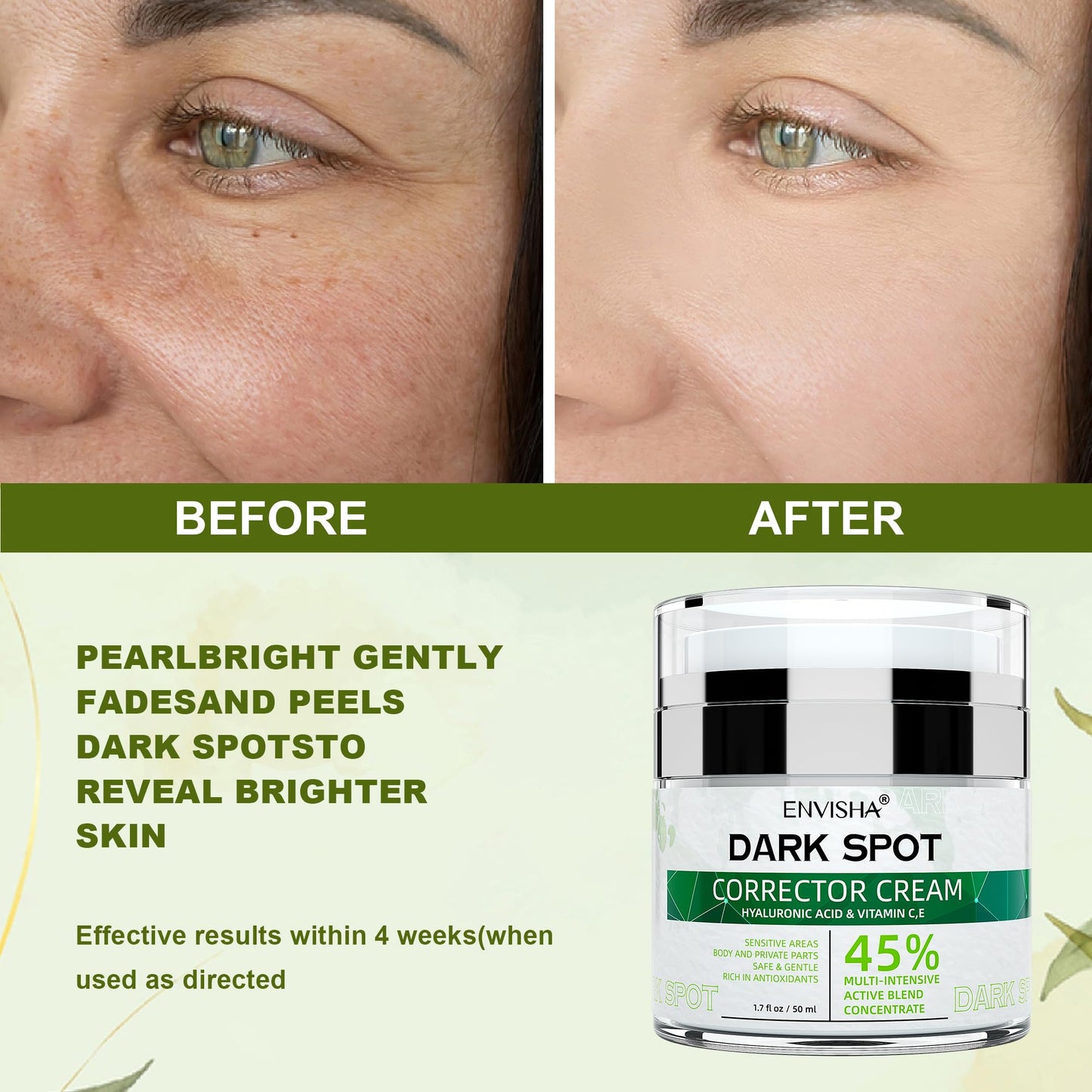 Dark Spot Remover Corrector for Face and Body, Dark Spot Corrector Cream,Moisturizer-Remover Sun Spot, Age Spot,Melasma, Freckles,Brown Spot Hyperpigmentation for Men and Women